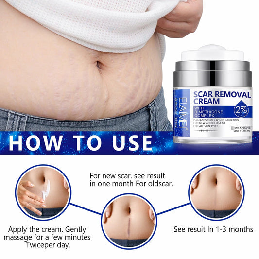 SCAR REMOVAL CREAM