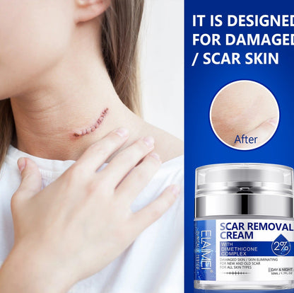 SCAR REMOVAL CREAM