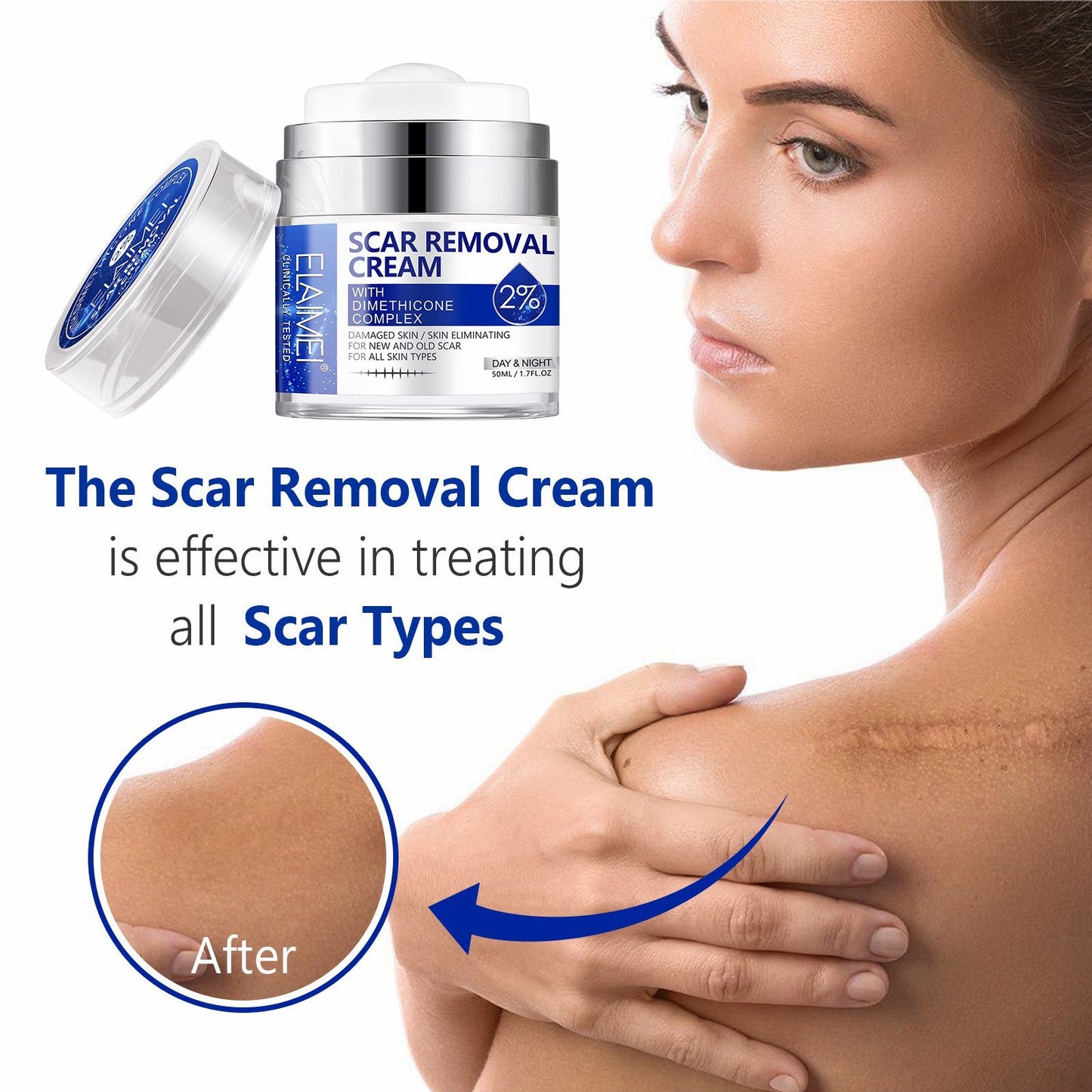 SCAR REMOVAL CREAM