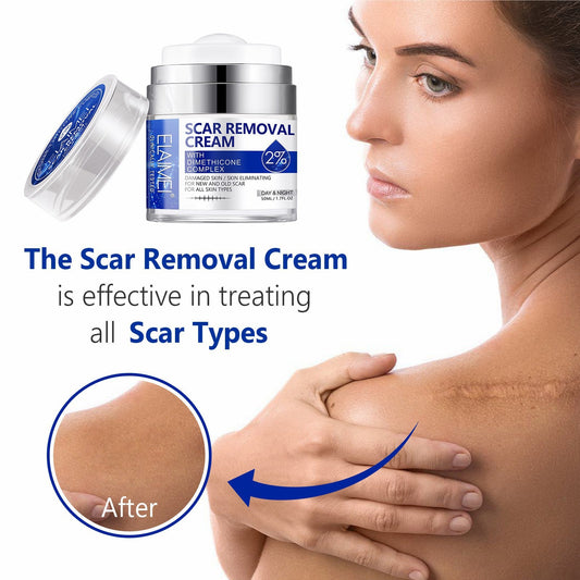 SCAR REMOVAL CREAM