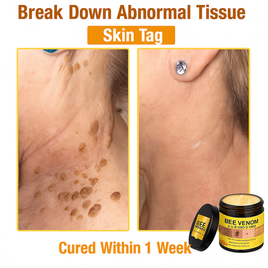 LOVILDS™ Bee Poison All-in-One Cream Dermatologist Approved