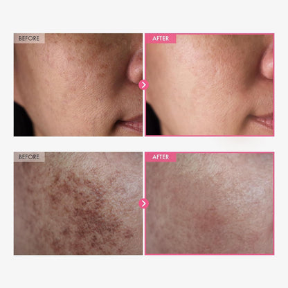 CollaGlow™ – Dark Spot Correcting Cream