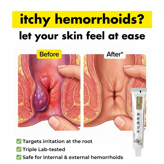 Dictmni™ - PileRelief Herbal Cream
